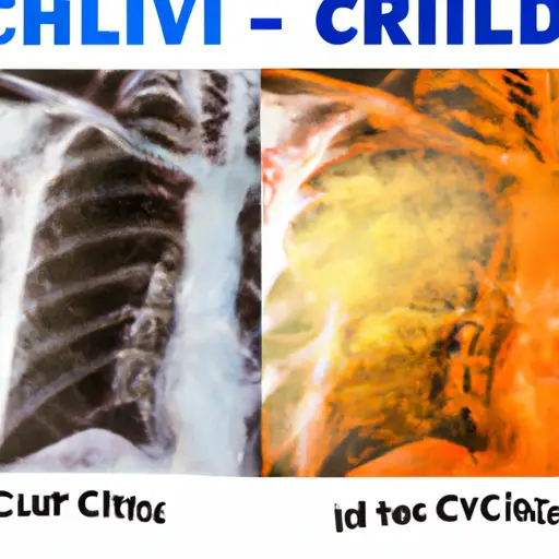 difference between cold flu and chest infection